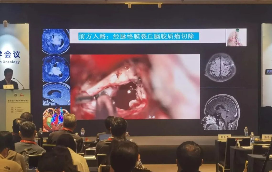 �ٽ����͵缫�����������缫�Ȳ�Ʒ��չ2024��ʮһ����ݹ�������ѧ�ۻ�